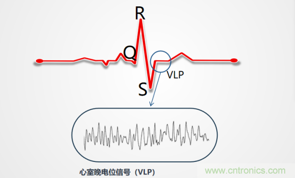 解決心電監(jiān)測行業(yè)難題，曼森伯格的濾波技術(shù)獲國家知識產(chǎn)權(quán)局發(fā)明授權(quán)