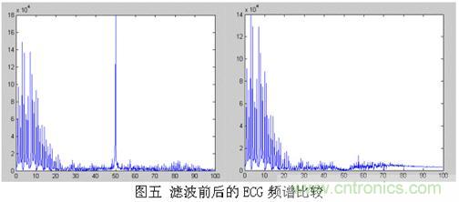 采用MSP430設(shè)計的12位心電(ECG)放大器 采用MSP430設(shè)計的12位心電(ECG)放大器